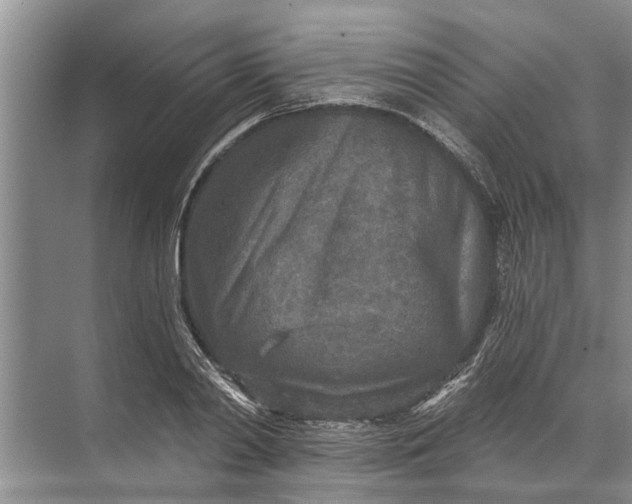 X0000071800790200607150145