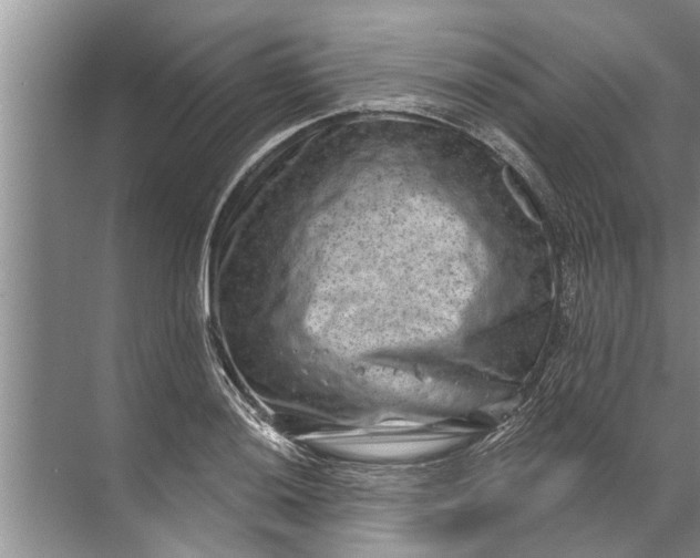 X0000071801036200607150141