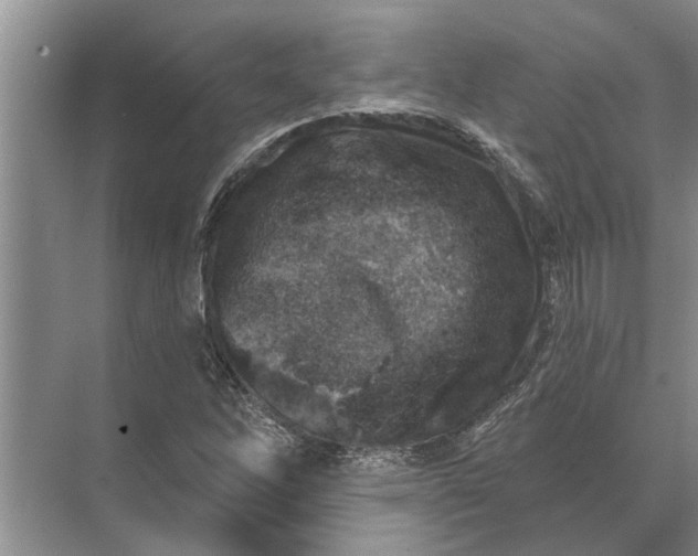 X0000071801262200607150137