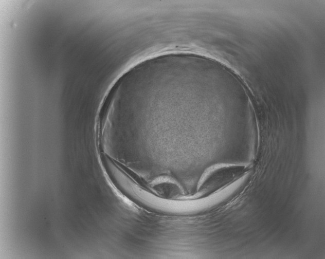 X0000071801519200607150133