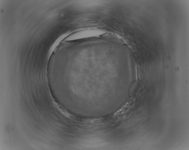 X0000071800147200607211655