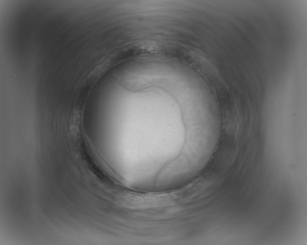 X0000071810036200606301238