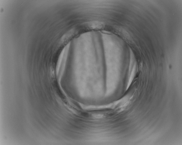 X0000071810176200607290001
