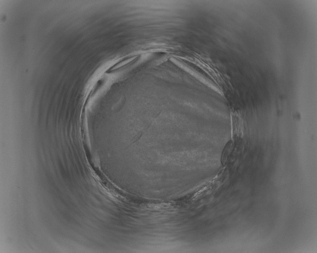 X0000071820147200607141644