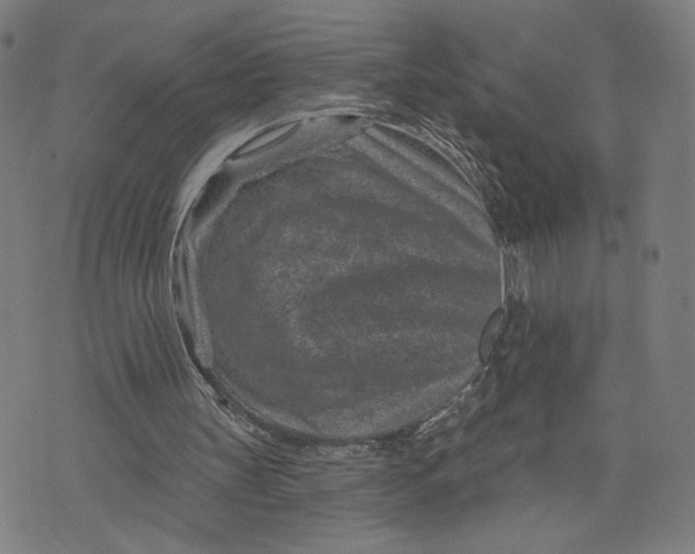 X0000071820147200607211745