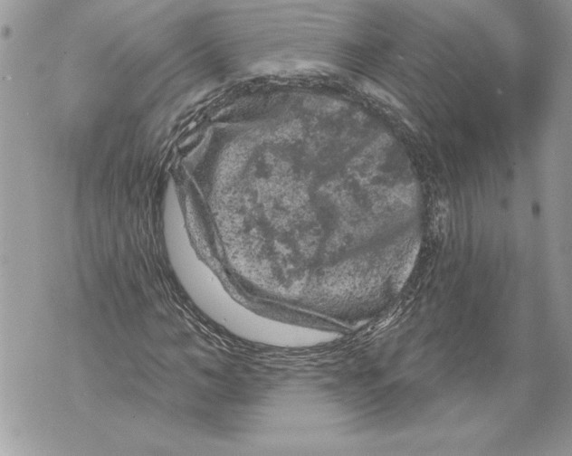 X0000071850966200607290128