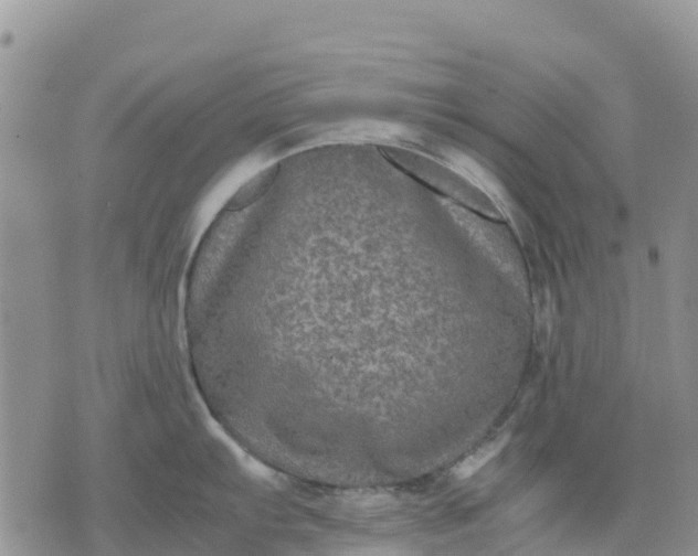 X0000071861103200607141809