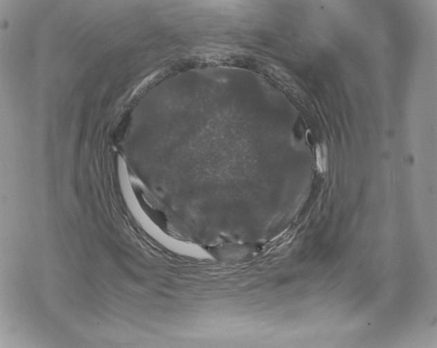 X0000071861155200607290150