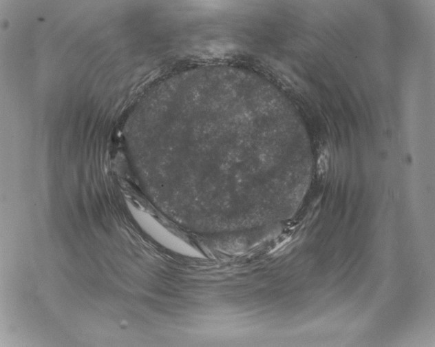 X0000071861156200607290150