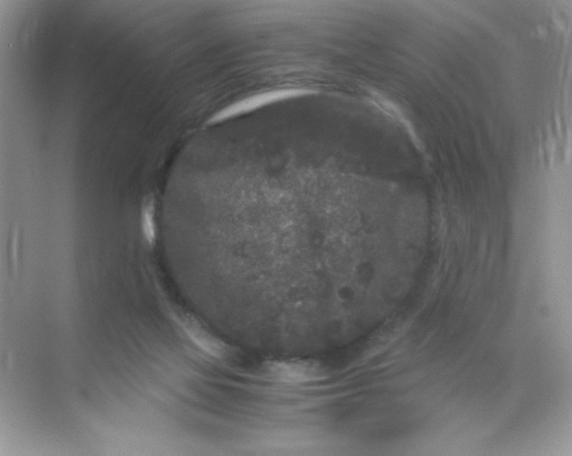 X0000071900069200607212027