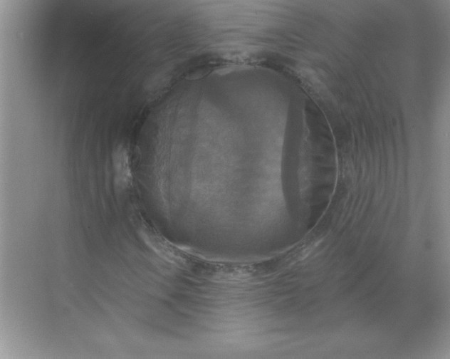 X0000071911106200607212035