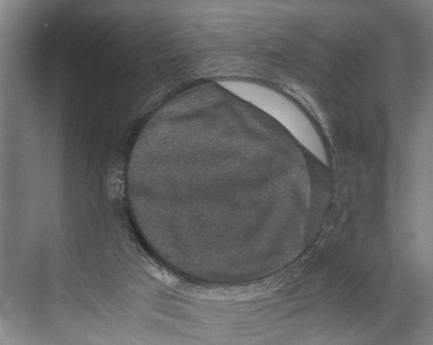 X0000071920017200608041447