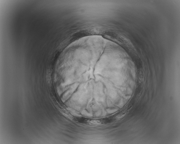 X0000071920409200608041440