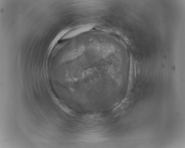 X0000071960147200607282042