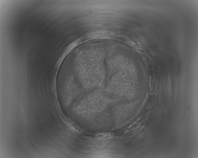 X0000071960099200608041629