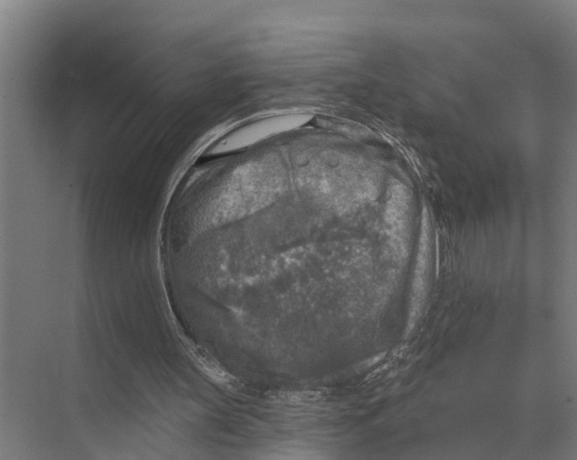 X0000071960147200608041628