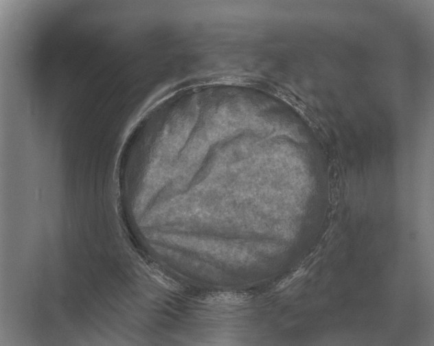 X0000071960198200608041628