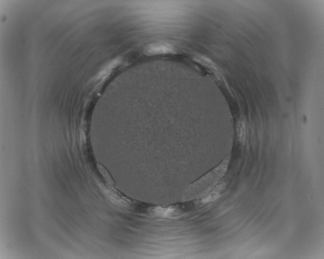 X0000072500570200607141132