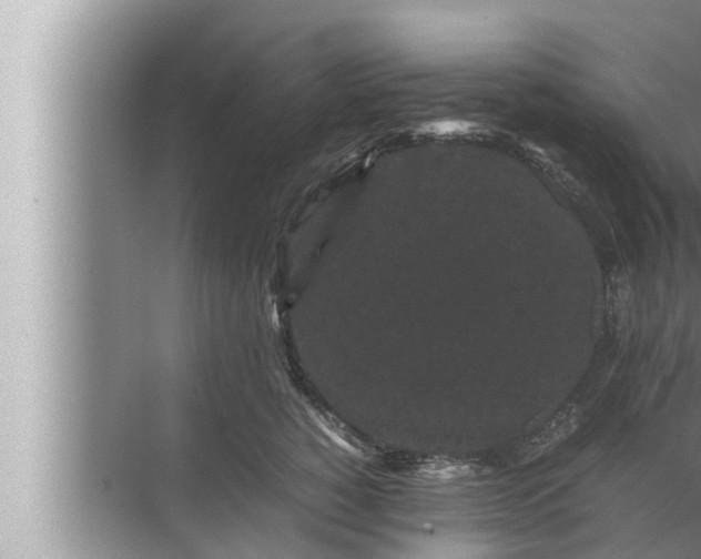 X0000072500760200607290105