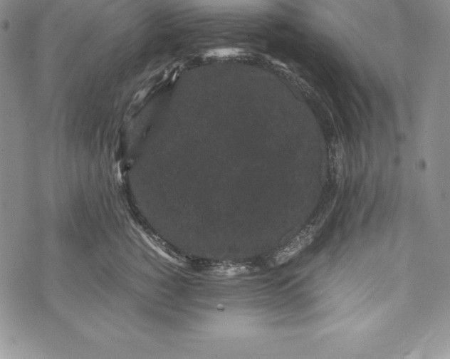 X0000072500760200608041441