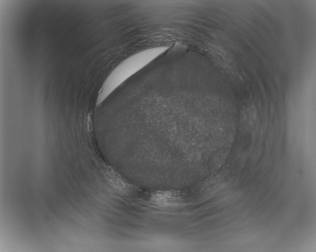 X0000072500177200608111637