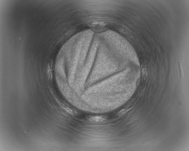 X0000072500460200608111632