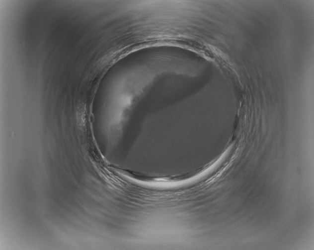 X0000072501161200608111620