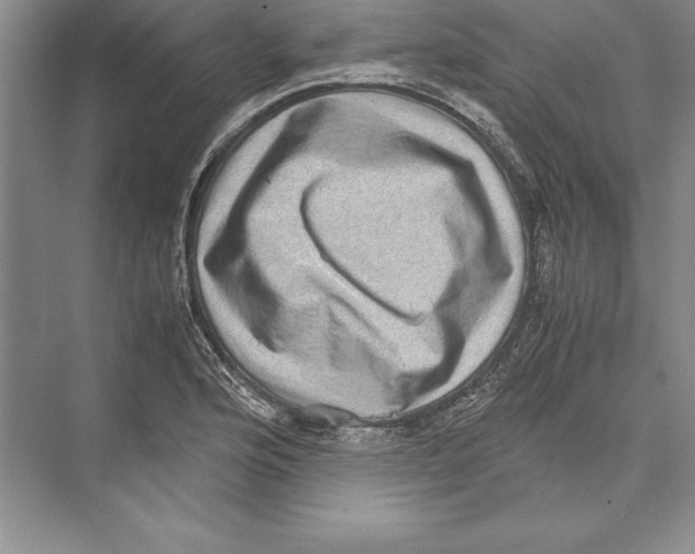 X0000072501176200608111620