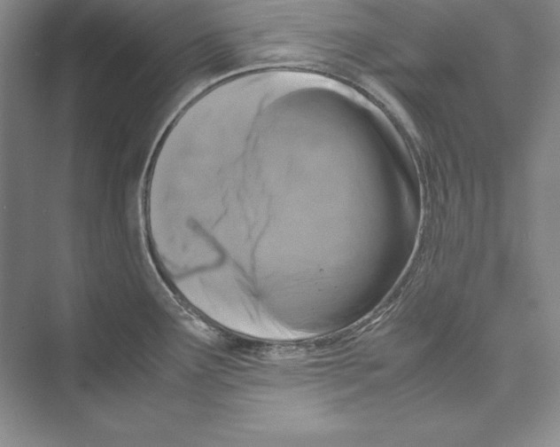 X0000072501291200608111618