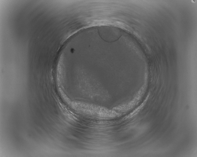 X0000072501497200608111614