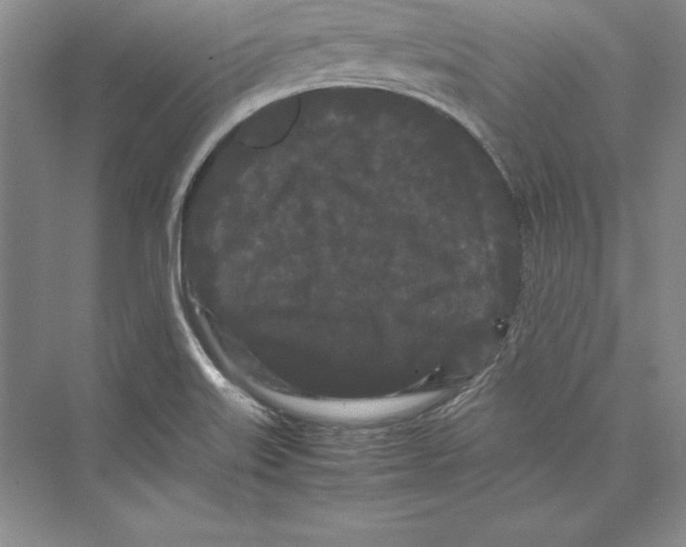 X0000072501515200608111615