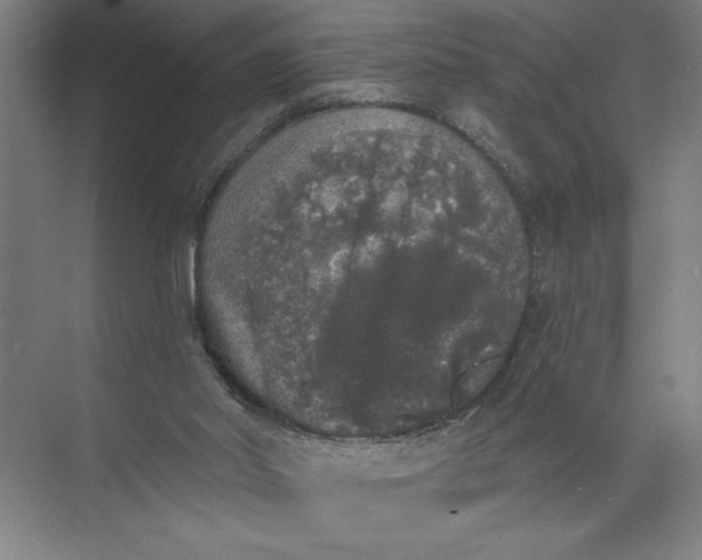 X0000072510014200607290144