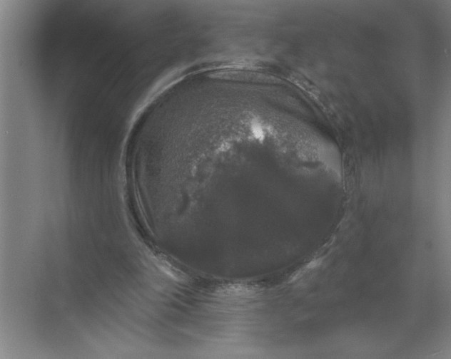 X0000072510198200607290141