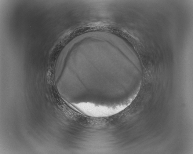 X0000072511254200608111645
