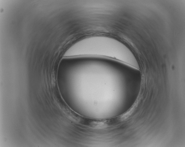 X0000072520170200607140946