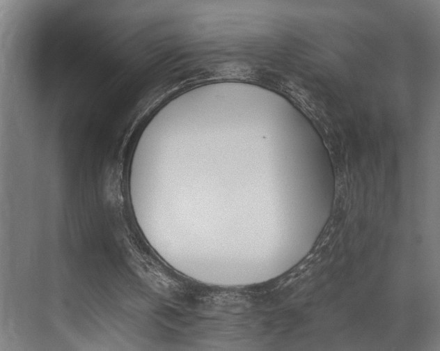 X0000072520146200607141207