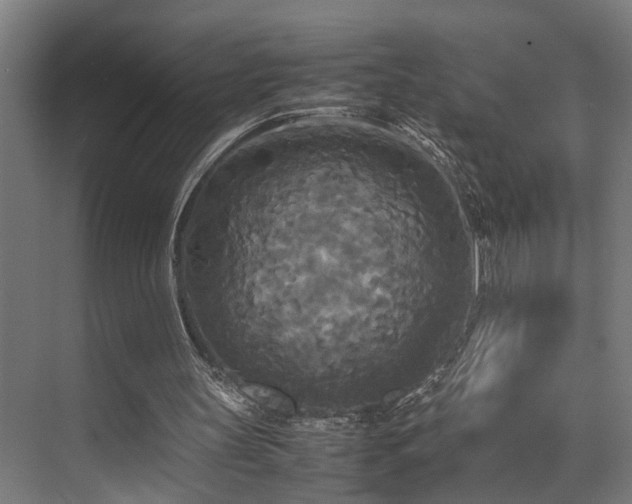 X0000072520147200607141207