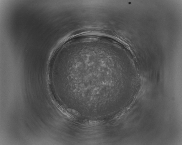 X0000072520149200607141207