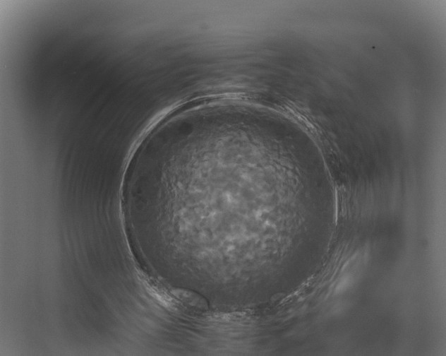 X0000072520147200607211432