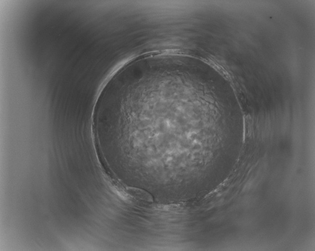 X0000072520147200607290207