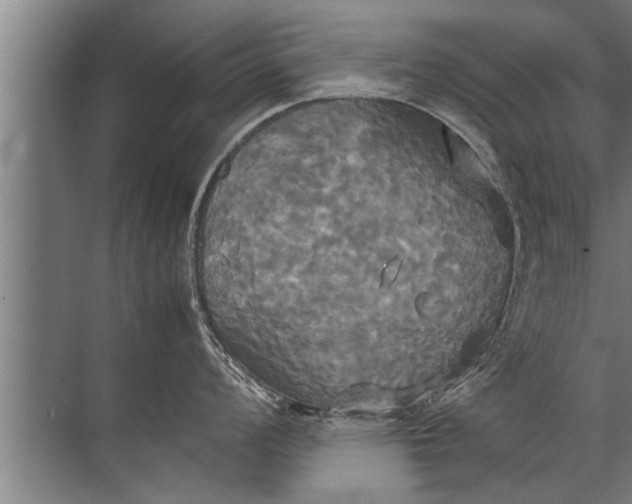 X0000072521008200607290153