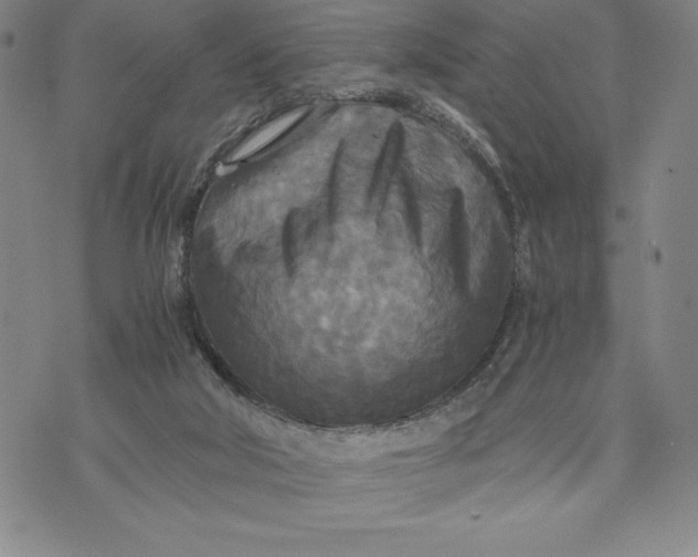 X0000072520018200608041543