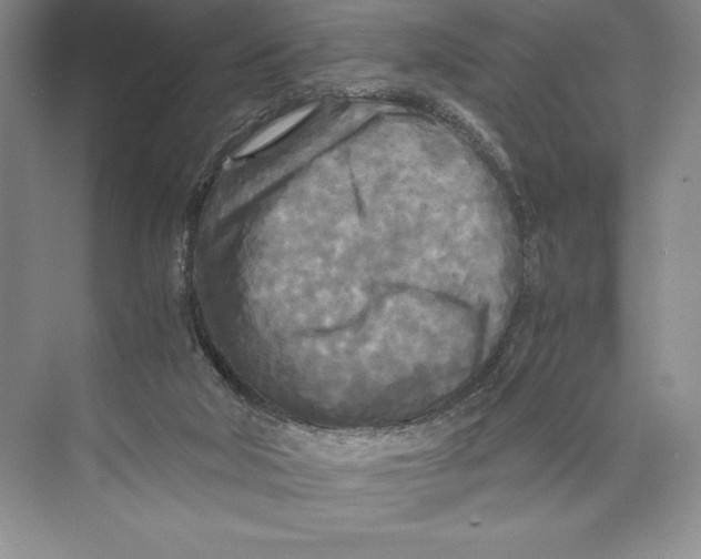 X0000072520018200608111732