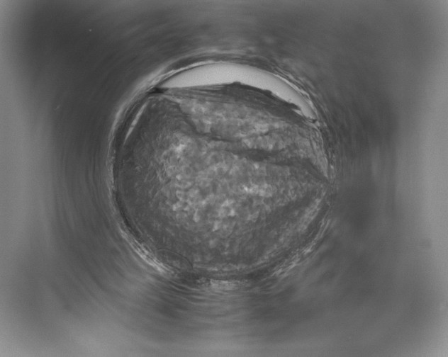 X0000072520149200608111729