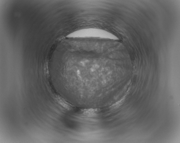 X0000072520182200608111730