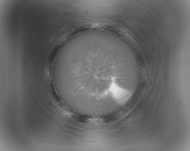 X0000072520415200608111725