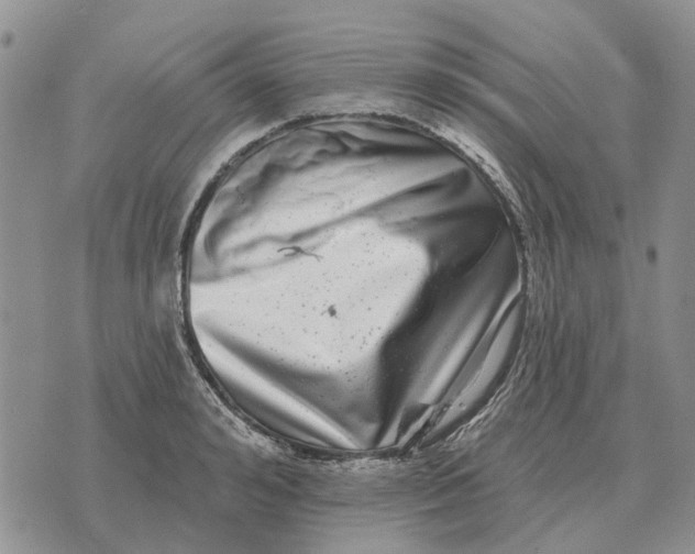 X0000072540992200608041618
