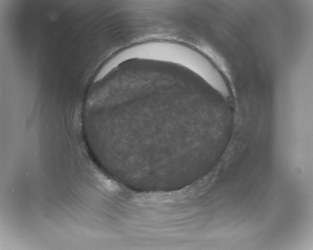 X0000072540009200608111825