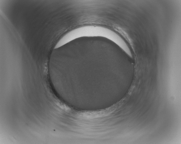 X0000072540017200608111825