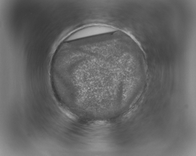 X0000072540151200608111822